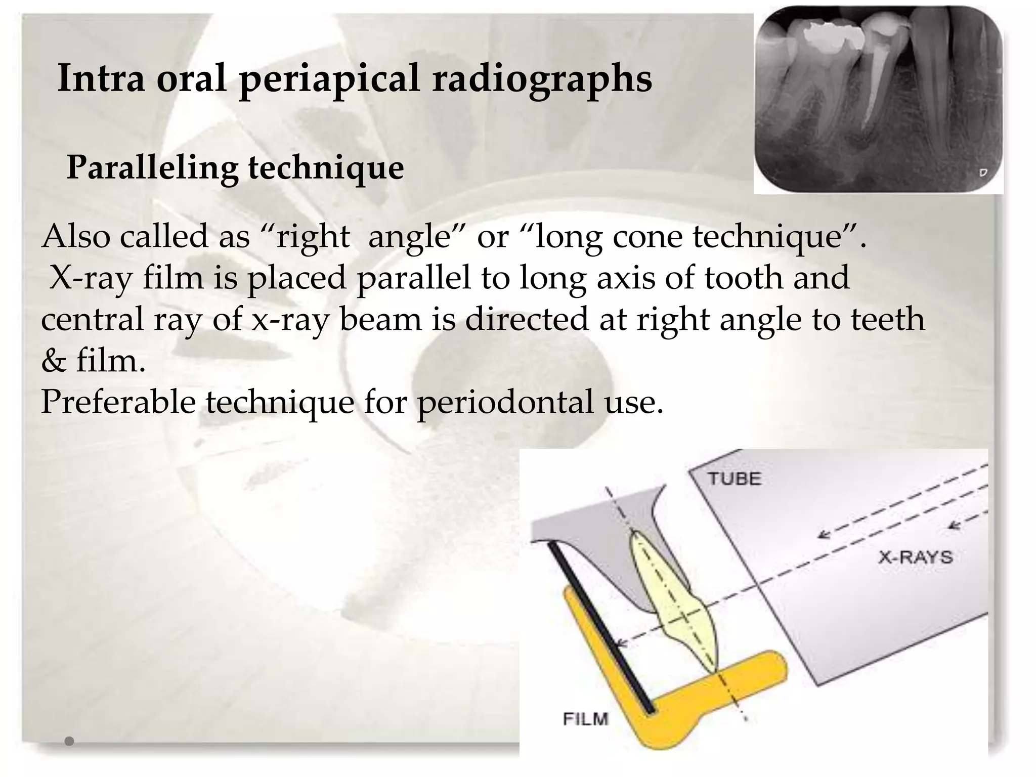Advanced radiographic aids in periodontics | PPTX