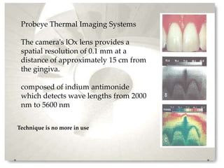 Advanced radiographic aids in periodontics | PPTX