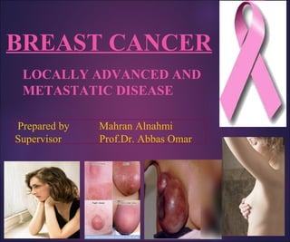 BREAST CANCER
LOCALLY ADVANCED AND
METASTATIC DISEASE
Prepared by Mahran Alnahmi
Supervisor Prof.Dr. Abbas Omar
 