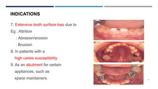 24
7. Extensive tooth surface loss due to
Eg : Attrition
: Abrasion/erosion
: Bruxism
8. In patients with a
high caries susceptibility
9. As an abutment for certain
appliances, such as
space maintainers.
INDICATIONS
 