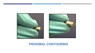PROXIMAL CONTOURING
 