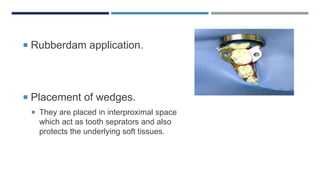  Rubberdam application.
 Placement of wedges.
 They are placed in interproximal space
which act as tooth seprators and also
protects the underlying soft tissues.
 