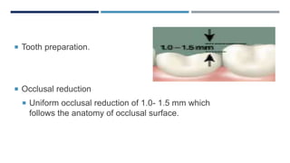  Tooth preparation.
 Occlusal reduction
 Uniform occlusal reduction of 1.0- 1.5 mm which
follows the anatomy of occlusal surface.
 