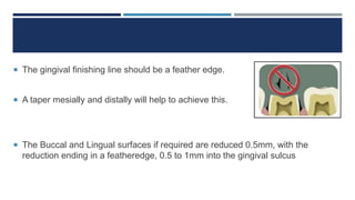  The gingival finishing line should be a feather edge.
 A taper mesially and distally will help to achieve this.
 The Buccal and Lingual surfaces if required are reduced 0.5mm, with the
reduction ending in a featheredge, 0.5 to 1mm into the gingival sulcus
 