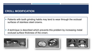 CROLL MODIFICATION
 Patients with tooth grinding habits may tend to wear through the occlusal
surfaces of stainless steel crowns.
 A technique is described which prevents this problem by increasing metal
occlusal surface thickness of the crown.
7/9/2019 74
 