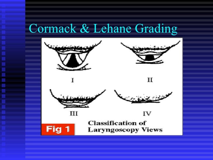 Advanced airwaymanagement