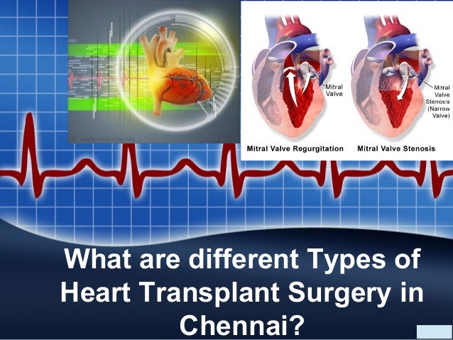 types of cardiothoracic surgery