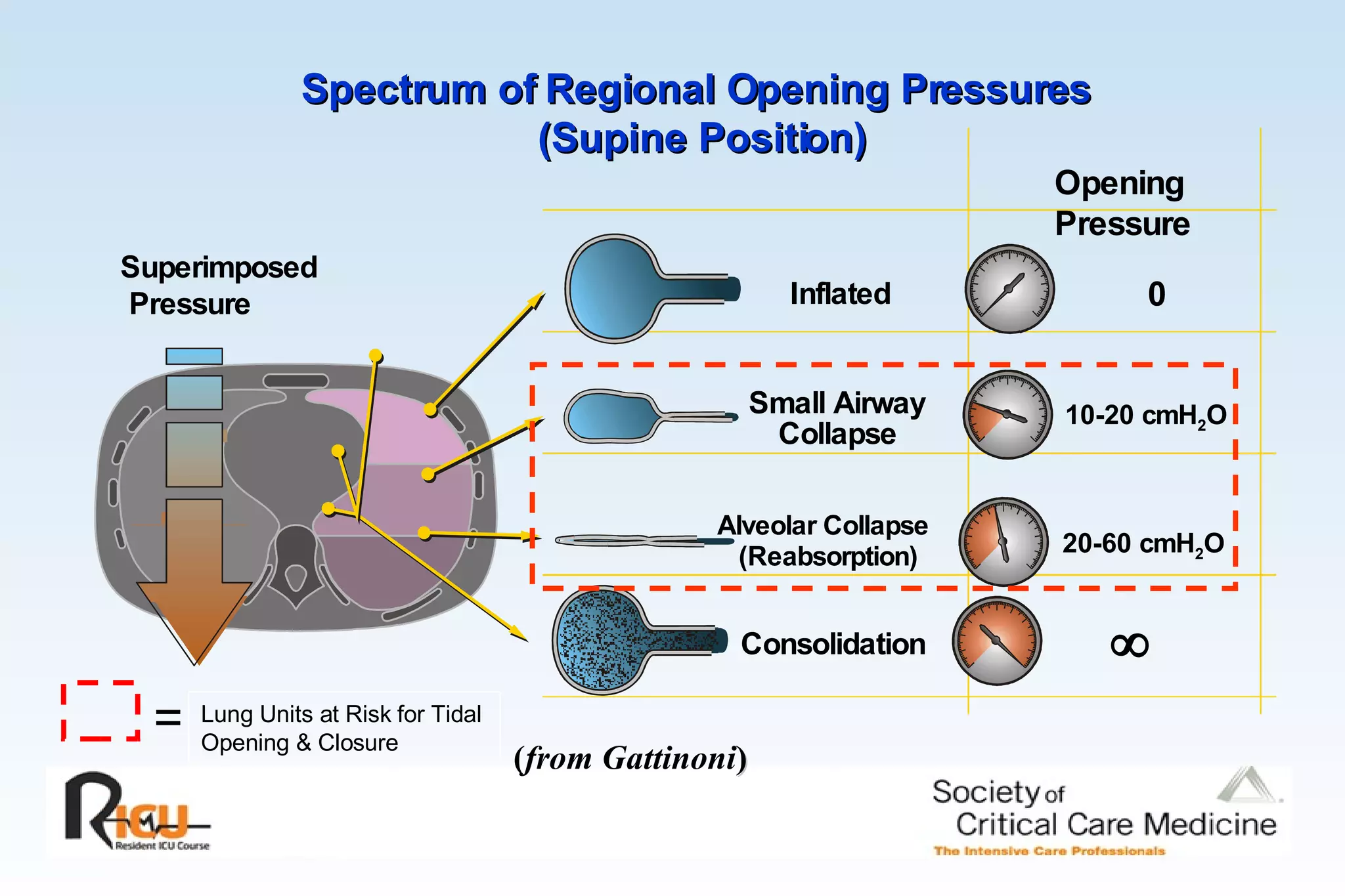 Spectrum of Regional Opening Pressures  (Supine Position) Superimposed Pressure ( from Gattinoni ) Lung Units at Risk for Tidal  Opening & Closure = Inflated 0 Alveolar Collapse (Reabsorption) 20-60 cmH 2 O Small Airway Collapse 10-20 cmH 2 O Consolidation  Opening Pressure 