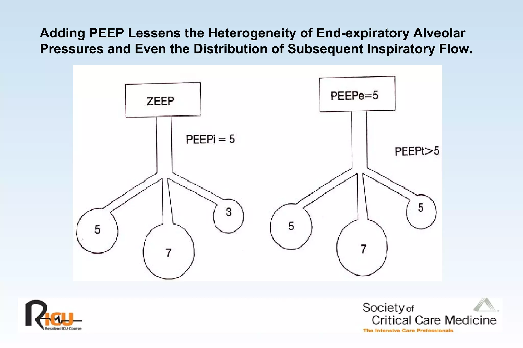 Adding PEEP Lessens the Heterogeneity of End-expiratory Alveolar Pressures and Even the Distribution of Subsequent Inspiratory Flow.   