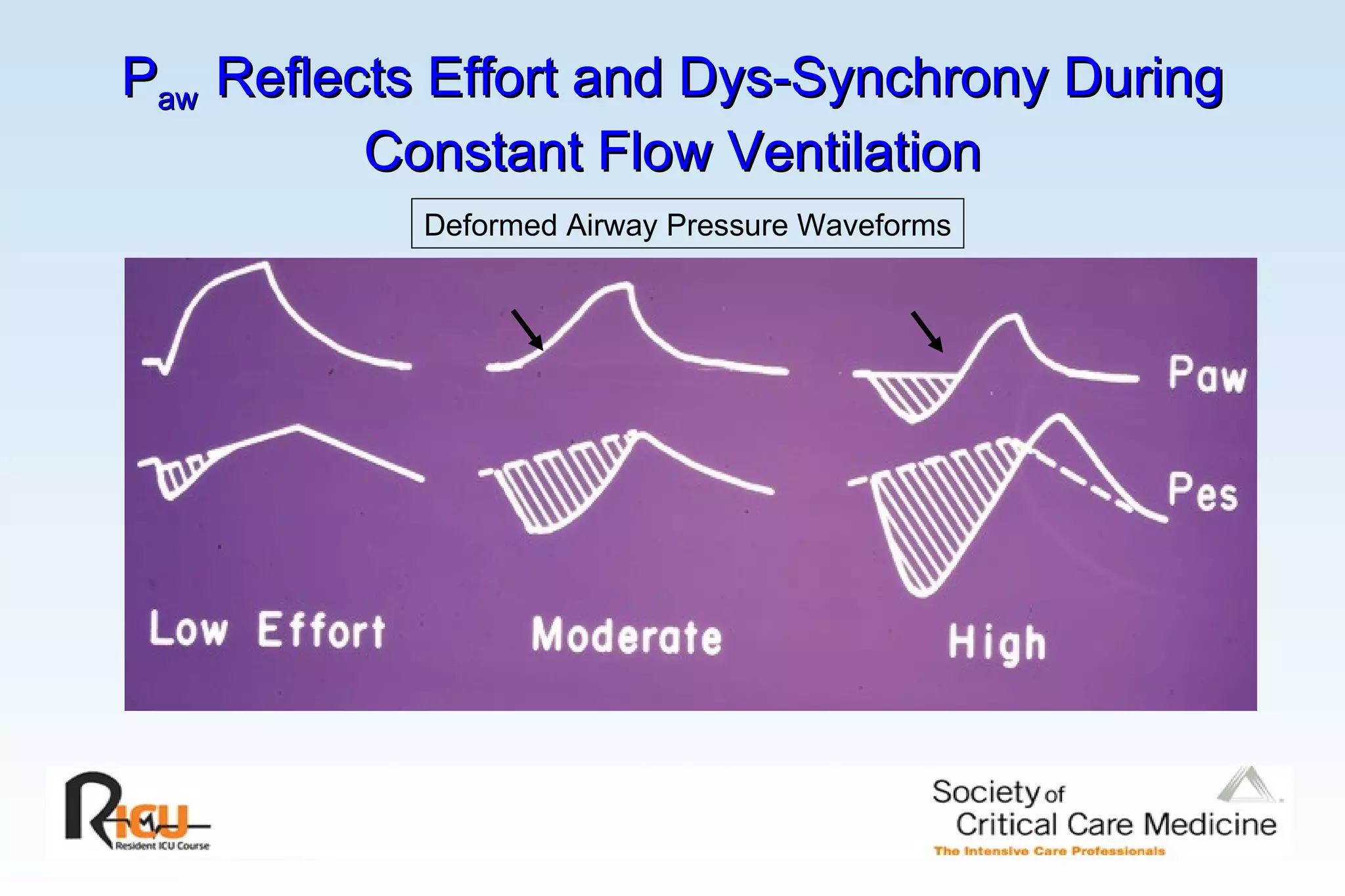 P aw  Reflects Effort and Dys-Synchrony During Constant Flow Ventilation Deformed Airway Pressure Waveforms 