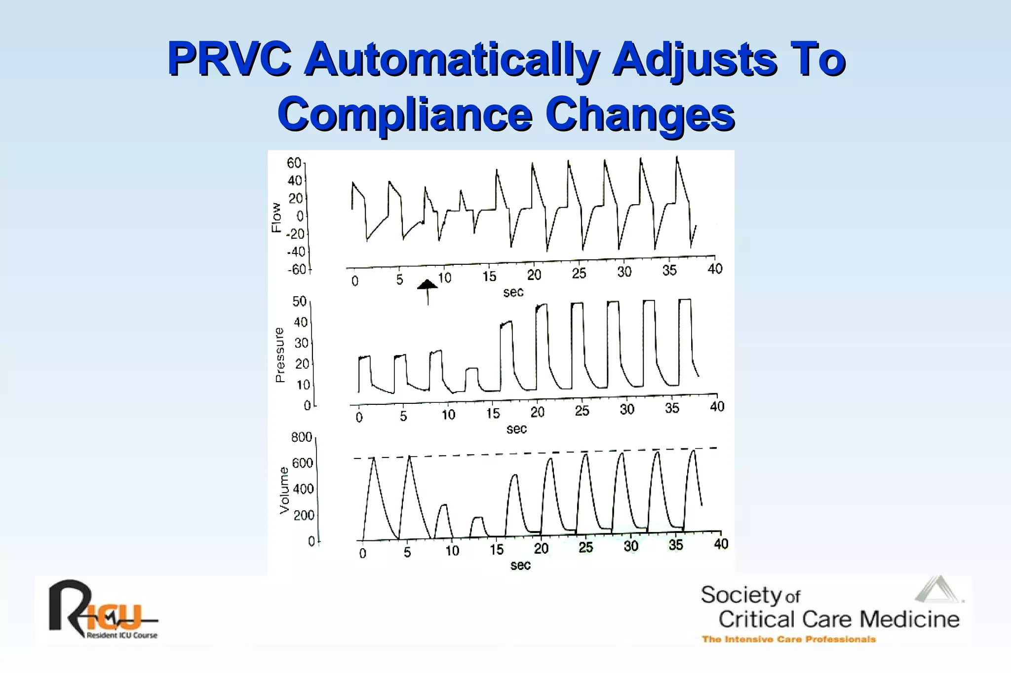 PRVC Automatically Adjusts To Compliance Changes 