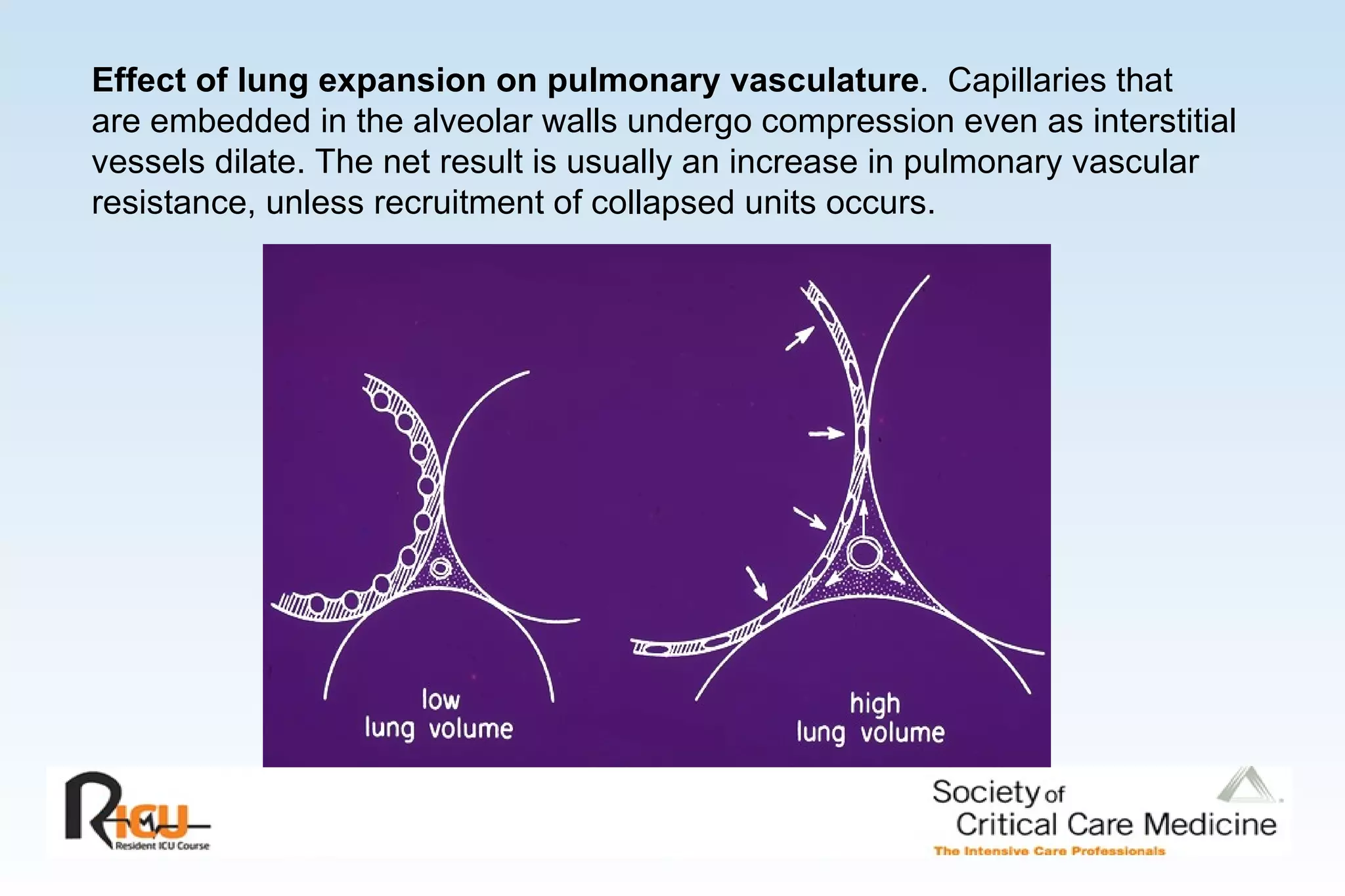 Effect of lung expansion on pulmonary vasculature .  Capillaries that are embedded in the alveolar walls undergo compression even as interstitial vessels dilate. The net result is usually an increase in pulmonary vascular resistance, unless recruitment of collapsed units occurs.  
