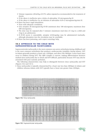 CHAPTER 10 THE CHILD WITH AN ABNORMAL PULSE RATE OR RHYTHM 111
• Volume expansion (20ml/kg of 0.9% saline repeated as recommended in the treatment of
shock).
• If the above is ineffective give a bolus of adrenaline 10 micrograms/kg IV.
• If the above is ineffective try an infusion of adrenaline 0.05–2 micrograms/kg/min IV.
• If there has been vagal stimulation:
• Treat with adequate ventilation.
• Give atropine 20 micrograms/kg IV/IO (minimum dose 100 micrograms; maximum dose
600 micrograms).
• The dose may be repeated after 5 minutes (maximum total dose of 1mg in a child and
2mg in an adolescent).
• If IV/IO access is unavailable, atropine (0.04mg/kg) may be administered tracheally,
although absorption into the circulation may be unreliable.
• If there has been poisoning, seek expert toxicology help.
10.5 APPROACH TO THE CHILD WITH
SUPRAVENTRICULAR TACHYCARDIA
Supraventricular tachycardia is the most common non-arrest arrhythmia during childhood and
is the most common arrhythmia that produces cardiovascular instability during infancy. SVT
in infants generally produces a heart rate >220bpm, and often 250–300bpm. Lower heart rates
occur in children during SVT. The QRS complex is narrow, making differentiation between
marked sinus tachycardia due to shock and SVT difﬁcult, particularly because SVT may also be
associated with poor systemic perfusion.
The following characteristics may help to distinguish between sinus tachycardia and SVT
(Figures 10.2 and 10.3):
• Sinus tachycardia is typically characterised by a heart rate less than 200bpm in infants and
children whereas infants with SVT typically have a heart rate greater than 220bpm.
Figure 10.2 Sinus tachycardia
Figure 10.3 Supraventricular tachycardia
 