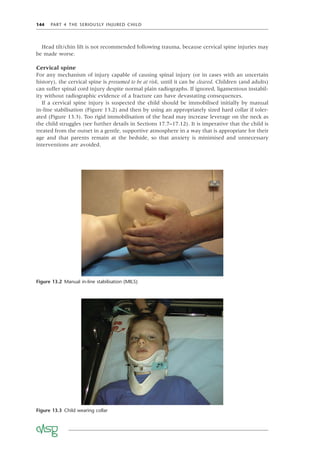 144 PART 4 THE SERIOUSLY INJURED CHILD
Head tilt/chin lift is not recommended following trauma, because cervical spine injuries may
be made worse.
Cervical spine
For any mechanism of injury capable of causing spinal injury (or in cases with an uncertain
history), the cervical spine is presumed to be at risk, until it can be cleared. Children (and adults)
can suffer spinal cord injury despite normal plain radiographs. If ignored, ligamentous instabil-
ity without radiographic evidence of a fracture can have devastating consequences.
If a cervical spine injury is suspected the child should be immobilised initially by manual
in-line stabilisation (Figure 13.2) and then by using an appropriately sized hard collar if toler-
ated (Figure 13.3). Too rigid immobilisation of the head may increase leverage on the neck as
the child struggles (see further details in Sections 17.7–17.12). It is imperative that the child is
treated from the outset in a gentle, supportive atmosphere in a way that is appropriate for their
age and that parents remain at the bedside, so that anxiety is minimised and unnecessary
interventions are avoided.
Figure 13.2 Manual in-line stabilisation (MILS)
Figure 13.3 Child wearing collar
 