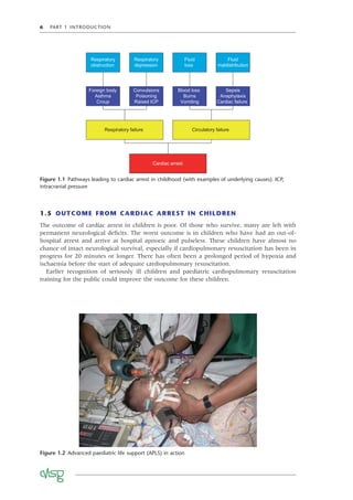 6 PART 1 INTRODUCTION
Figure 1.1 Pathways leading to cardiac arrest in childhood (with examples of underlying causes). ICP,
intracranial pressure
Respiratory
obstruction
Respiratory
depression
Fluid
loss
Fluid
maldistribution
Foreign body
Asthma
Croup
Convulsions
Poisoning
Raised ICP
Blood loss
Burns
Vomiting
Sepsis
Anaphylaxis
Cardiac failure
Respiratory failure Circulatory failure
Cardiac arrest
Figure 1.2 Advanced paediatric life support (APLS) in action
1.5 OUTCOME FROM CARDIAC ARREST IN CHILDREN
The outcome of cardiac arrest in children is poor. Of those who survive, many are left with
permanent neurological deﬁcits. The worst outcome is in children who have had an out-of-
hospital arrest and arrive at hospital apnoeic and pulseless. These children have almost no
chance of intact neurological survival, especially if cardiopulmonary resuscitation has been in
progress for 20 minutes or longer. There has often been a prolonged period of hypoxia and
ischaemia before the start of adequate cardiopulmonary resuscitation.
Earlier recognition of seriously ill children and paediatric cardiopulmonary resuscitation
training for the public could improve the outcome for these children.
 