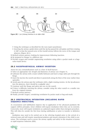 204 PART 5 PRACTICAL APPLICATION OF APLS
• Using the technique as described for the non-expert practitioner.
• Inserting the airway upside down until the tip has passed the soft palate and then rotating
it 180° so that the natural curve of the Guedel airway follows the curve of the tongue and
pharynx (Figure 20.1).
3 Recheck airway patency, looking for improvement following insertion.
4 Be prepared to change to a different size.
5 Provide oxygen and consider augmenting ventilation using either a pocket mask or a bag–
valve–mask device.
20.2 NASOPHARYNGEAL AIRWAY INSERTION
Assess for any contraindications such as a base of skull fracture.
1 Select an appropriate size (length and diameter) of airway (see Chapter 5).
2 Lubricate the airway with a water-soluble lubricant and insert a large safety pin through the
ﬂange.
3 Insert the tip into the nostril and direct it posteriorly along the ﬂoor of the nose (rather than
upwards).
4 Gently pass the airway past the turbinates with a slight rotating motion. As the tip advances
into the pharynx, there should be a palpable ‘give’.
5 Continue until the ﬂange and safety pin rest on the nostril.
6 If there is difﬁculty inserting the airway, consider using the other nostril or a smaller size
from the original estimate.
7 Recheck airway patency.
8 Finally, provide oxygen, considering ventilation by pocket mask or bag-and-mask.
20.3 OROTRACHEAL INTUBATION (INCLUDING RAPID
SEQUENCE INDUCTION)
As resuscitation and stabilisation improve due to application of the advanced paediatric life
support (APLS) principles, fewer children will require intubation when they are in extremis.
Conversely, more will require intubation as a planned urgent rather than emergent procedure.
This will often be outside the ﬁrst hour during stabilisation or prior to transfer to deﬁnitive
care.
Intubation may need to be carried out in the referring hospital prior to the arrival of a
retrieval team and will require anaesthesia/sedation and muscle relaxation if the child is con-
scious. The technique used to secure the airway rapidly and safely in this situation is known
as rapid sequence induction (RSI).
Figure 20.1 (a–c) Airway insertion in an older child
(a) (b) (c)
 