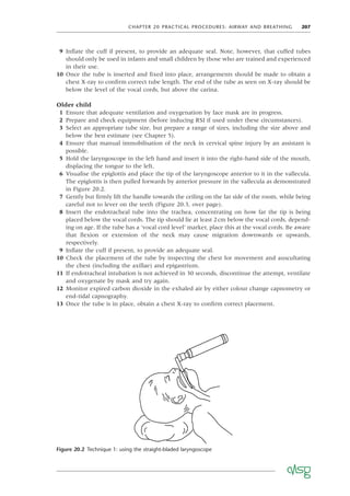 CHAPTER 20 PRACTICAL PROCEDURES: AIRWAY AND BREATHING 207
9 Inﬂate the cuff if present, to provide an adequate seal. Note, however, that cuffed tubes
should only be used in infants and small children by those who are trained and experienced
in their use.
10 Once the tube is inserted and ﬁxed into place, arrangements should be made to obtain a
chest X-ray to conﬁrm correct tube length. The end of the tube as seen on X-ray should be
below the level of the vocal cords, but above the carina.
Older child
1 Ensure that adequate ventilation and oxygenation by face mask are in progress.
2 Prepare and check equipment (before inducing RSI if used under these circumstances).
3 Select an appropriate tube size, but prepare a range of sizes, including the size above and
below the best estimate (see Chapter 5).
4 Ensure that manual immobilisation of the neck in cervical spine injury by an assistant is
possible.
5 Hold the laryngoscope in the left hand and insert it into the right-hand side of the mouth,
displacing the tongue to the left.
6 Visualise the epiglottis and place the tip of the laryngoscope anterior to it in the vallecula.
The epiglottis is then pulled forwards by anterior pressure in the vallecula as demonstrated
in Figure 20.2.
7 Gently but ﬁrmly lift the handle towards the ceiling on the far side of the room, while being
careful not to lever on the teeth (Figure 20.3, over page).
8 Insert the endotracheal tube into the trachea, concentrating on how far the tip is being
placed below the vocal cords. The tip should lie at least 2cm below the vocal cords, depend-
ing on age. If the tube has a ‘vocal cord level’ marker, place this at the vocal cords. Be aware
that ﬂexion or extension of the neck may cause migration downwards or upwards,
respectively.
9 Inﬂate the cuff if present, to provide an adequate seal.
10 Check the placement of the tube by inspecting the chest for movement and auscultating
the chest (including the axillae) and epigastrium.
11 If endotracheal intubation is not achieved in 30 seconds, discontinue the attempt, ventilate
and oxygenate by mask and try again.
12 Monitor expired carbon dioxide in the exhaled air by either colour change capnometry or
end-tidal capnography.
13 Once the tube is in place, obtain a chest X-ray to conﬁrm correct placement.
Figure 20.2 Technique 1: using the straight-bladed laryngoscope
 