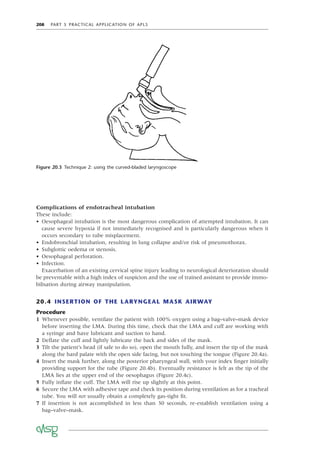 208 PART 5 PRACTICAL APPLICATION OF APLS
Complications of endotracheal intubation
These include:
• Oesophageal intubation is the most dangerous complication of attempted intubation. It can
cause severe hypoxia if not immediately recognised and is particularly dangerous when it
occurs secondary to tube misplacement.
• Endobronchial intubation, resulting in lung collapse and/or risk of pneumothorax.
• Subglottic oedema or stenosis.
• Oesophageal perforation.
• Infection.
Exacerbation of an existing cervical spine injury leading to neurological deterioration should
be preventable with a high index of suspicion and the use of trained assistant to provide immo-
bilisation during airway manipulation.
20.4 INSERTION OF THE LARYNGEAL MASK AIRWAY
Procedure
1 Whenever possible, ventilate the patient with 100% oxygen using a bag–valve–mask device
before inserting the LMA. During this time, check that the LMA and cuff are working with
a syringe and have lubricant and suction to hand.
2 Deﬂate the cuff and lightly lubricate the back and sides of the mask.
3 Tilt the patient’s head (if safe to do so), open the mouth fully, and insert the tip of the mask
along the hard palate with the open side facing, but not touching the tongue (Figure 20.4a).
4 Insert the mask further, along the posterior pharyngeal wall, with your index ﬁnger initially
providing support for the tube (Figure 20.4b). Eventually resistance is felt as the tip of the
LMA lies at the upper end of the oesophagus (Figure 20.4c).
5 Fully inﬂate the cuff. The LMA will rise up slightly at this point.
6 Secure the LMA with adhesive tape and check its position during ventilation as for a tracheal
tube. You will not usually obtain a completely gas-tight ﬁt.
7 If insertion is not accomplished in less than 30 seconds, re-establish ventilation using a
bag–valve–mask.
Figure 20.3 Technique 2: using the curved-bladed laryngoscope
 