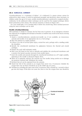 210 PART 5 PRACTICAL APPLICATION OF APLS
20.5 SURGICAL AIRWAY
Cricothyroidotomy is a ‘technique of failure’. It is indicated if a patent airway cannot be
achieved by other means. It must be performed promptly and decisively when necessary. In
children under the age of 12 years, needle cricothyroidotomy is preferred to surgical cricothy-
roidotomy. In the adolescent either technique can be used but the surgical technique allows
better protection of the airway. The relevant anatomy is shown in Figure 20.5.
In a very small baby, or if a foreign body is below the cricoid ring, direct tracheal puncture
using the same technique can be used.
Needle cricothyroidotomy
This technique is simple in concept, but far from easy in practice. In an emergency situation
the child may be struggling and attempts to breathe or swallow may result in the larynx moving
up and down:
1 Attach a cricothyroidotomy cannula-over-needle (or, if not available, an intravenous
cannula and needle) of an appropriate size to a 5ml syringe.
2 Place the patient in a supine position.
3 If there is no risk of cervical spine injury, extend the neck, perhaps with a sandbag under
the shoulders.
4 Identify the cricothyroid membrane by palpitation between the thyroid and cricoid
cartilages.
5 Prepare the neck with antiseptic swabs.
6 Place your left hand on the neck to identify and stabilise the cricothyroid membrane and
to protect the lateral vascular structures from needle injury.
7 Insert the needle and cannula through the cricothyroid membrane at a 45° angle caudally,
aspirating as the needle is advanced (Figure 20.6).
8 When air is aspirated, advance the cannula over the needle, being careful not to damage
the posterior tracheal wall. Withdraw the needle.
9 Recheck that air can be aspirated from the cannula.
10 Attach the hub of the cannula to an oxygen ﬂow meter via a Y-connector. Initially the
oxygen ﬂow rate (in litres) should be set at the child’s age (in years).
11 Ventilate by occluding the open end of the Y-connector with a thumb for 1 second to direct
gas into the lungs. If this does not cause the chest to rise the oxygen ﬂow rate should be
Figure 20.5 Surgical airway anatomy
 