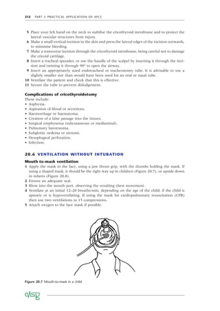 212 PART 5 PRACTICAL APPLICATION OF APLS
5 Place your left hand on the neck to stabilise the cricothyroid membrane and to protect the
lateral vascular structures from injury.
6 Make a small vertical incision in the skin and press the lateral edges of the incision outwards,
to minimise bleeding.
7 Make a transverse incision through the cricothyroid membrane, being careful not to damage
the cricoid cartilage.
8 Insert a tracheal spreader, or use the handle of the scalpel by inserting it through the inci-
sion and twisting it through 90° to open the airway.
9 Insert an appropriately sized endotracheal or tracheostomy tube. It is advisable to use a
slightly smaller size than would have been used for an oral or nasal tube.
10 Ventilate the patient and check that this is effective.
11 Secure the tube to prevent dislodgement.
Complications of cricothyroidotomy
These include:
• Asphyxia.
• Aspiration of blood or secretions.
• Haemorrhage or haematoma.
• Creation of a false passage into the tissues.
• Surgical emphysema (subcutaneous or mediastinal).
• Pulmonary barotrauma.
• Subglottic oedema or stenosis.
• Oesophageal perforation.
• Infection.
20.6 VENTILATION WITHOUT INTUBATION
Mouth-to-mask ventilation
1 Apply the mask to the face, using a jaw thrust grip, with the thumbs holding the mask. If
using a shaped mask, it should be the right way up in children (Figure 20.7), or upside down
in infants (Figure 20.8).
2 Ensure an adequate seal.
3 Blow into the mouth port, observing the resulting chest movement.
4 Ventilate at an initial 12–20 breaths/min, depending on the age of the child, if the child is
apnoeic or is hypoventilating. If using the mask for cardiopulmonary resuscitation (CPR)
then use two ventilations to 15 compressions.
5 Attach oxygen to the face mask if possible.
Figure 20.7 Mouth-to-mask in a child
 