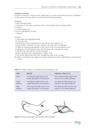 CHAPTER 21 PRACTICAL PROCEDURES: CIRCULATION 219
Venous cut-down
If speed is essential, it may be more appropriate to use the intraosseous route for immediate
access, and to cut down later for continued ﬂuid and drug therapy.
Equipment
• Skin-cleansing swabs.
• Lidocaine 1% for local anaesthetic with a 2ml syringe and a 25 gauge needle.
• Scalpel.
• Curved haemostats.
• Suture and ligature material.
• Cannula.
Procedure
1 Immobilise the appropriate limb.
2 Clean the skin.
3 Identify the surface landmarks for the relevant vein (Table 21.1).
4 If the child is responsive to pain, inﬁltrate the skin with 1% lidocaine.
5 Make an incision perpendicular to the course of the vein through the skin.
6 Using the curved haemostat tips, bluntly dissect the subcutaneous tissue.
7 Identify the vein and free 1–2cm in length.
8 Pass a proximal and a distal ligature (Figure 21.2).
9 Tie off the distal end of the vein, keeping the ends of the tie long.
10 Make a small hole in the upper part of the exposed vein with a scalpel blade or ﬁne-pointed
scissors.
Table 21.1 Surface anatomy of the brachial and long saphenous veins
Child Brachial Saphenous (Figure 21.2)
Infant One ﬁnger-breadth lateral to the
medial epicondyle of the humerus
Half a ﬁnger-breadth superior and
anterior to the medial malleolus
Small
children
Two ﬁnger-breadths lateral to the
medial epicondyle of the humerus
One ﬁnger-breadth superior and
anterior to the medial malleolus
Older
children
Three ﬁnger-breadths lateral to the
medial epicondyle of the humerus
Two ﬁnger-breadths superior and
anterior to the medial malleolus
Figure 21.2 Site of a long saphenous cut-down and its technique
 