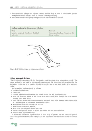 226 PART 5 PRACTICAL APPLICATION OF APLS
5 Attach the 5ml syringe and aspirate – blood marrow may be used to check blood glucose
and provide blood culture. Flush to conﬁrm correct positioning.
6 Attach the ﬁlled 20ml syringe and push in the infusion ﬂuid in boluses.
Figure 21.5 Tibial technique for intraosseous infusion
Surface anatomy for intraosseous infusions
Tibial Femoral
Anterior surface, 2–3cm below the tibial
tuberosity
Anterolateral surface, 3cm above the
lateral condyle
Other powered devices
The EZ-IO drill is a powered device that enables rapid insertion of an intraosseous needle. The
same landmarks are used as for manual insertion and the procedure is less painful for the
conscious victim due to its rapidity. The EZ-IO needles are in two sizes: under 40kg and over
40kg.
The procedure for insertion is as follows:
1 Universal precautions.
2 Clean site.
3 Choose appropriate size needle and attach to drill – it will ﬁx magnetically.
4 Hold the drill and needle at 90° to the skin surface and push through the skin without
drilling, until bone is felt.
5 Push the drill button and drill continuously and push until there is loss of resistance – there
is a palpable give as the needle breaches the cortex.
6 Remove the drill and unscrew the trochar.
7 Aspirate the marrow if possible.
8 Attach the pre-prepared connection tube.
9 There is an optional device to secure the needle but this is not essential.
10 Proceed with required therapy.
It should be noted that rapid infusion of ﬂuid may be painful for the conscious patient
and if this proves to be the case 0.5mg/kg of 2% lignocaine may be infused slowly to combat
this.
 