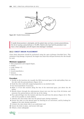 230 PART 5 PRACTICAL APPLICATION OF APLS
22.2 CHEST DRAIN PLACEMENT
Chest drain placement should be performed using the open technique described here. This
minimises lung damage. In general, the largest size drain that will pass between the ribs should
be used.
Minimum equipment
• Skin preparation and surgical drapes.
• Scalpel.
• Large clamps × 2.
• Suture.
• (Local anaesthetic.)
• Scissors.
• Chest drain tube.
Procedure
1 Decide on the insertion site (usually the ﬁfth intercostal space in the mid-axillary line) on
the side with the pneumothorax (Figure 22.2).
2 Swab the chest wall with surgical preparation or an alcohol swab.
3 Use local anaesthetic if necessary.
4 Make a 2–3cm skin incision along the line of the intercostal space, just above the rib
below.
5 Bluntly dissect through the subcutaneous tissues just over the top of the rib below, and
puncture the parietal pleura with the tip of the clamp.
6 Put a gloved ﬁnger into the incision and clear the path into the pleura (Figure 22.3). This
will not be possible in small children.
7 Advance the chest drain tube into the pleural space during expiration.
8 Ensure the tube is in the pleural space by listening for air movement, and by looking for
fogging of the tube during expiration.
9 Connect the chest drain tube to an underwater seal.
10 Suture the drain in place, and secure with tape.
11 Obtain a chest radiograph.
Figure 22.1 Needle thoracocentesis
If needle thoracocentesis is attempted, and the patient does not have a tension pneumothorax,
the risk of causing a pneumothorax is 10–20%. Patients who have had this procedure must
have a chest radiograph, and will require chest drainage if ventilated.
 