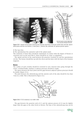 CHAPTER 23 INTERPRETING TRAUMA X-RAYS 241
Figure 23.1 Lateral cervical spine showing the anatomy and three of the four review lines and disc spaces
(facet joints and line not shown). F, facet joint; L, lamina; Od, odontoid; SP, spinous process spaces.
Foramen
magnum
1
2
3
4
5
6
7
1 2 3 4
T1
Clivus
Cervical spine review alignment
The cord lies between 2 and 4
Occiput
The gap between the posterior arch of C1 and the spinous process of C2 may be slightly
larger than the gaps at the other levels in ﬂexion. The base of the odontoid peg may not be
Figure 23.2 C1/C2 anatomy in an older child
3 The facet line.
4 The spinolaminar line (posterior wall of the spinal canal).
The continuity of these lines should be maintained, no matter what the degree of ﬂexion or
extension seen on the neck ﬁlm is. There should be no ‘steps’ or angulation.
The spinal cord lies in the canal between the posterior vertebral (2) and the spinolaminar
(4) line. The former should line up with the clivus and the latter with the back of the foramen
magnum.
Bones
The outline of each vertebra should be reviewed in turn. Fracture lines going through the
cortex, vertebral bodies, laminae or spinous processes should be sought.
The spaces between the facet joints and the gaps between adjacent spinous processes should
be similar (Figure 23.1).
The joint between the odontoid peg and the anterior arch of the atlas should be less than
3mm in a child. This is illustrated in Figure 23.2.
 