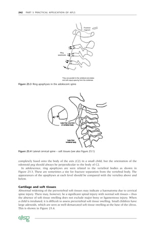242 PART 5 PRACTICAL APPLICATION OF APLS
Figure 23.4 Lateral cervical spine – soft tissues (see also Figure 23.1)
completely fused onto the body of the axis (C2) in a small child, but the orientation of the
odontoid peg should always be perpendicular to the body of C2.
In adolescence, ring apophyses are seen related to the vertebral bodies as shown in
Figure 23.3. These are sometimes a site for fracture separation from the vertebral body. The
appearances of the apophyses at each level should be compared with the vertebra above and
below.
Cartilage and soft tissues
Abnormal widening of the prevertebral soft tissues may indicate a haematoma due to cervical
spine injury. There may, however, be a signiﬁcant spinal injury with normal soft tissues – thus
the absence of soft tissue swelling does not exclude major bony or ligamentous injury. When
a child is intubated, it is difﬁcult to assess prevertebral soft tissue swelling. Small children have
large adenoids, which are seen as well-demarcated soft tissue swelling at the base of the clivus.
This is shown in Figure 23.4.
Figure 23.3 Ring apophyses in the adolescent spine
 