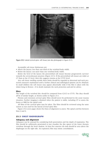 CHAPTER 23 INTERPRETING TRAUMA X-RAYS 243
Acceptable soft tissue thicknesses are:
• Above the larynx: less than one-third of the vertebral body width.
• Below the larynx: not more than one vertebral body width.
Below the level of the larynx the prevertebral soft tissues become progressively narrower
towards the cervicothoracic junction (Figure 23.5). If the prevertebral soft tissues are wider at
C7 than at the C5 level, then this suggests trauma at the C7/T1 level.
Any soft tissue swelling outside these limits should be regarded as abnormal and neck pro-
tection measures maintained until a further clinical and radiological opinion can be obtained.
In small children the soft tissues may appear abnormally wide if the ﬁlm is taken with the
infant lying in ﬂexion – if in doubt maintain the neck protection and ask for advice.
Discs
The height of the vertebral disc should be compared from C2/C3 to C7/T1. The discs should
all be of similar height, as shown earlier in Figure 23.1.
Flexion and extension cervical spine ﬁlms should never be performed in the acute trauma
situation. Further imaging is obtained when the patient is stable, including CT to assess the
bones or MRI for the spinal cord.
AP ﬁlms of the cervical spine may be taken. The ﬁlms should be reviewed using the same
system as was used for the lateral cervical spine ﬁlm:
Figure 23.6 (over page) shows ﬁve lines of alignment to assess. The spinal cord lies between
lines 2 and 4.
23.3 CHEST RADIOGRAPH
Adequacy and alignment
Adequacy can be assessed by considering both penetration and the depth of inspiration. The
ﬁlm should be sufﬁciently penetrated to just visualise the disc spaces of the lower thoracic
vertebrae through the heart shadow. At least ﬁve anterior rib ends should be seen above the
diaphragm on the right side. An expiratory ﬁlm may mimic consolidation.
Figure 23.5 Lateral cervical spine: soft tissues (see also photograph in Figure 23.1)
 