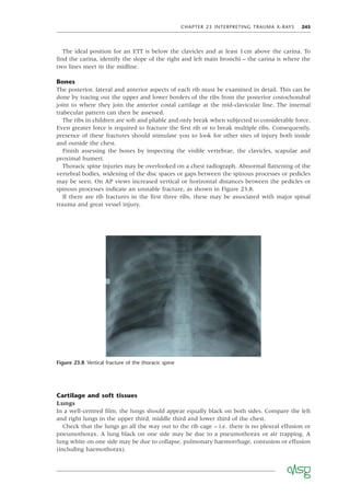 CHAPTER 23 INTERPRETING TRAUMA X-RAYS 245
The ideal position for an ETT is below the clavicles and at least 1cm above the carina. To
ﬁnd the carina, identify the slope of the right and left main bronchi – the carina is where the
two lines meet in the midline.
Bones
The posterior, lateral and anterior aspects of each rib must be examined in detail. This can be
done by tracing out the upper and lower borders of the ribs from the posterior costochondral
joint to where they join the anterior costal cartilage at the mid-clavicular line. The internal
trabecular pattern can then be assessed.
The ribs in children are soft and pliable and only break when subjected to considerable force.
Even greater force is required to fracture the ﬁrst rib or to break multiple ribs. Consequently,
presence of these fractures should stimulate you to look for other sites of injury both inside
and outside the chest.
Finish assessing the bones by inspecting the visible vertebrae, the clavicles, scapulae and
proximal humeri.
Thoracic spine injuries may be overlooked on a chest radiograph. Abnormal ﬂattening of the
vertebral bodies, widening of the disc spaces or gaps between the spinous processes or pedicles
may be seen. On AP views increased vertical or horizontal distances between the pedicles or
spinous processes indicate an unstable fracture, as shown in Figure 23.8.
If there are rib fractures in the ﬁrst three ribs, these may be associated with major spinal
trauma and great vessel injury.
Figure 23.8 Vertical fracture of the thoracic spine
Cartilage and soft tissues
Lungs
In a well-centred ﬁlm, the lungs should appear equally black on both sides. Compare the left
and right lungs in the upper third, middle third and lower third of the chest.
Check that the lungs go all the way out to the rib cage – i.e. there is no pleural effusion or
pneumothorax. A lung black on one side may be due to a pneumothorax or air trapping. A
lung white on one side may be due to collapse, pulmonary haemorrhage, contusion or effusion
(including haemothorax).
 