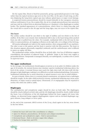 246 PART 5 PRACTICAL APPLICATION OF APLS
On the supine ﬁlm, blood or ﬂuid lies posteriorly, giving a generalised greyness to the lung,
rather than the typical meniscus sign seen on the erect ﬁlm. At the apex of each lung, an effu-
sion displacing the lung down (apical cap) may indicate spinal injury or major vessel damage.
A suspected tension pneumothorax should be treated clinically in the emergency situation,
without conﬁrmatory X-ray. On a supine ﬁlm, the air in a simple pneumothorax rises anteriorly
and may only be evident from an abnormal blackness or ‘sharpness’ of the diaphragm or cardiac
border. The standard appearances of a pneumothorax, where there is a sharp lung edge and
the vessels fail to extend to the rib cage and the lung edges, may not occur in the supine ﬁlm.
The heart
The cardiac outline should lie one-third to the right of midline and two-thirds to the left of
midline. If the ﬁlm is not rotated, then mediastinal shift is due to the heart being either pushed
from one side or pulled from the other. For example, mediastinal shift to the left may be due
either to a pneumothorax, air trapping or effusion on the right side, or to collapse of the left lung.
All trauma radiographs are taken in the supine position, often using portable X-ray machines.
The tube is near to the patient and the heart is anterior with the ﬁlm posterior. The heart in
this situation appears abnormally magniﬁed (widened) and the cardiothoracic ratio is difﬁcult
to assess on supine AP ﬁlms.
The mediastinal cardiac outline should be clear on both sides. Any loss of deﬁnition suggests
consolidation (de-aeration) of adjacent lungs. A ‘globular’ shape to the heart may suggest a
pericardial effusion. Tamponade is managed clinically, not radiologically. A cardiac echo is useful
in equivocal cases.
The upper mediastinum
In the teenager, the mediastinum should appear as narrow as in an adult. In children under the
age of 18 months, the normal thymus may simulate superior mediastinal widening (above the
level of the carina). A normal thymus may touch the right chest wall, left chest wall, left dia-
phragmorrightdiaphragm,makingitverydifﬁculttoexcludemediastinalpathology.Fortunately,
mediastinal widening due to aortic dissection or spinal trauma is very rare in small children.
In cases of doubt, where there is a normal clinical examination, an opinion from a radiologist
should be sought. In the older child involved in trauma, mediastinal widening may mean aortic
dissection, or major vessel or spinal injury. Ultrasound, CT or angiography may be required to
resolve this when the child is stable.
Diaphragms
The cardiophrenic and costophrenic angles should be clear on both sides. The diaphragms
should be clearly deﬁned on both sides and the left diaphragm should be clearly visible behind
the heart. Loss of deﬁnition of the left diaphragm behind the heart suggests left lower lobe
collapse, an abnormal hump suggests diaphragmatic rupture and an elevated diaphragm sug-
gests effusion, lung collapse or nerve palsy.
At the end of the systematic ABCD review of the X-ray, check again in the key areas shown
in the box below.
• Behind the heart (left lower lobe consolidation or collapse)
• Apices for effusions, pneumothorax, rib fractures and collapse/consolidation
• Costophrenic and cardiophrenic angles – ﬂuid or pneumothorax
• Horizontal ﬁssure – ﬂuid or elevation (upper lobe collapse)
• Trachea for foreign body (and ETT)
 