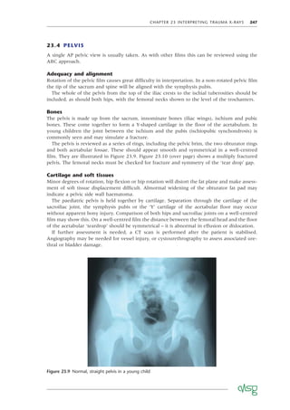 CHAPTER 23 INTERPRETING TRAUMA X-RAYS 247
23.4 PELVIS
A single AP pelvic view is usually taken. As with other ﬁlms this can be reviewed using the
ABC approach.
Adequacy and alignment
Rotation of the pelvic ﬁlm causes great difﬁculty in interpretation. In a non-rotated pelvic ﬁlm
the tip of the sacrum and spine will be aligned with the symphysis pubis.
The whole of the pelvis from the top of the iliac crests to the ischial tuberosities should be
included, as should both hips, with the femoral necks shown to the level of the trochanters.
Bones
The pelvis is made up from the sacrum, innominate bones (iliac wings), ischium and pubic
bones. These come together to form a Y-shaped cartilage in the ﬂoor of the acetabulum. In
young children the joint between the ischium and the pubis (ischiopubic synchondrosis) is
commonly seen and may simulate a fracture.
The pelvis is reviewed as a series of rings, including the pelvic brim, the two obturator rings
and both acetabular fossae. These should appear smooth and symmetrical in a well-centred
ﬁlm. They are illustrated in Figure 23.9. Figure 23.10 (over page) shows a multiply fractured
pelvis. The femoral necks must be checked for fracture and symmetry of the ‘tear drop’ gap.
Cartilage and soft tissues
Minor degrees of rotation, hip ﬂexion or hip rotation will distort the fat plane and make assess-
ment of soft tissue displacement difﬁcult. Abnormal widening of the obturator fat pad may
indicate a pelvic side wall haematoma.
The paediatric pelvis is held together by cartilage. Separation through the cartilage of the
sacroiliac joint, the symphysis pubis or the ‘Y’ cartilage of the acetabular ﬂoor may occur
without apparent bony injury. Comparison of both hips and sacroiliac joints on a well-centred
ﬁlm may show this. On a well-centred ﬁlm the distance between the femoral head and the ﬂoor
of the acetabular ‘teardrop’ should be symmetrical – it is abnormal in effusion or dislocation.
If further assessment is needed, a CT scan is performed after the patient is stabilised.
Angiography may be needed for vessel injury, or cystourethrography to assess associated ure-
thral or bladder damage.
Figure 23.9 Normal, straight pelvis in a young child
 