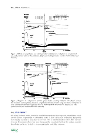 332 PART 6 APPENDICES
Figure I.2 Effects of lung inﬂation and a brief period of ventilation on a baby born in early terminal
apnoea but before failure of the circulation. (Reproduced with permission from the Northern Neonatal
Network)
Figure I.3 Response of a baby born in terminal apnoea. In this case lung inﬂation is not sufﬁcient because
the circulation is already failing. However, lung inﬂation delivers air to the lungs and then a brief period of
chest compressions delivers oxygenated blood to the heart which then responds. (Reproduced with
permission from the Northern Neonatal Network)
I.4 EQUIPMENT
For many newborn babies, especially those born outside the delivery room, the need for resus-
citation cannot be predicted. It is therefore useful to plan for such an eventuality. Equipment
that may be required to resuscitate a newborn baby is listed in the box below. This will vary
between departments; however, most babies can be resuscitated with a ﬂat surface, warmth,
knowledge and a way to deliver air or oxygen at a controlled pressure.
 