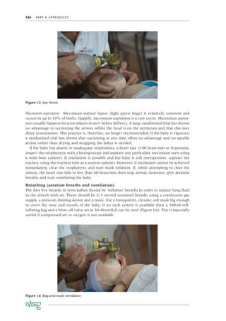 336 PART 6 APPENDICES
Figure I.6 Bag-and-mask ventilation
Figure I.5 Jaw thrust
Meconium aspiration Meconium-stained liquor (light green tinge) is relatively common and
occurs in up to 10% of births. Happily, meconium aspiration is a rare event. Meconium aspira-
tion usually happens in term infants in utero before delivery. A large randomised trial has shown
no advantage to suctioning the airway whilst the head is on the perineum and that this may
delay resuscitation. This practice is, therefore, no longer recommended. If the baby is vigorous,
a randomised trial has shown that suctioning at any time offers no advantage and no speciﬁc
action (other than drying and wrapping the baby) is needed.
If the baby has absent or inadequate respirations, a heart rate <100 beats/min or hypotonia,
inspect the oropharynx with a laryngoscope and aspirate any particulate meconium seen using
a wide-bore catheter. If intubation is possible and the baby is still unresponsive, aspirate the
trachea, using the tracheal tube as a suction catheter. However, if intubation cannot be achieved
immediately, clear the oropharynx and start mask inﬂation. If, while attempting to clear the
airway, the heart rate falls to less than 60 beats/min then stop airway clearance, give aeration
breaths and start ventilating the baby.
Breathing (aeration breaths and ventilation)
The ﬁrst ﬁve breaths in term babies should be ‘inﬂation’ breaths in order to replace lung ﬂuid
in the alveoli with air. These should be 2–3 second sustained breaths using a continuous gas
supply, a pressure-limiting device and a mask. Use a transparent, circular, soft mask big enough
to cover the nose and mouth of the baby. If no such system is available then a 500ml self-
inﬂating bag and a blow-off valve set at 30–40cmH2O can be used (Figure I.6). This is especially
useful if compressed air or oxygen is not available.
 