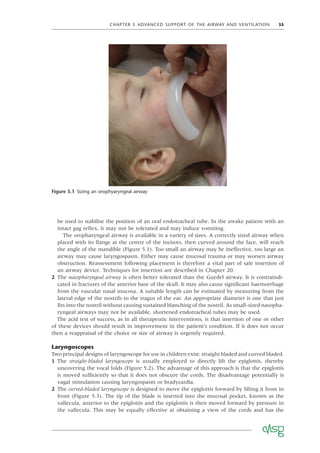 CHAPTER 5 ADVANCED SUPPORT OF THE AIRWAY AND VENTILATION 35
be used to stabilise the position of an oral endotracheal tube. In the awake patient with an
intact gag reﬂex, it may not be tolerated and may induce vomiting.
The oropharyngeal airway is available in a variety of sizes. A correctly sized airway when
placed with its ﬂange at the centre of the incisors, then curved around the face, will reach
the angle of the mandible (Figure 5.1). Too small an airway may be ineffective, too large an
airway may cause laryngospasm. Either may cause mucosal trauma or may worsen airway
obstruction. Reassessment following placement is therefore a vital part of safe insertion of
an airway device. Techniques for insertion are described in Chapter 20.
2 The nasopharyngeal airway is often better tolerated than the Guedel airway. It is contraindi-
cated in fractures of the anterior base of the skull. It may also cause signiﬁcant haemorrhage
from the vascular nasal mucosa. A suitable length can be estimated by measuring from the
lateral edge of the nostrils to the tragus of the ear. An appropriate diameter is one that just
ﬁts into the nostril without causing sustained blanching of the nostril. As small-sized nasopha-
ryngeal airways may not be available, shortened endotracheal tubes may be used.
The acid test of success, as in all therapeutic interventions, is that insertion of one or other
of these devices should result in improvement in the patient’s condition. If it does not occur
then a reappraisal of the choice or size of airway is urgently required.
Laryngoscopes
Two principal designs of laryngoscope for use in children exist: straight bladed and curved bladed.
1 The straight-bladed laryngoscope is usually employed to directly lift the epiglottis, thereby
uncovering the vocal folds (Figure 5.2). The advantage of this approach is that the epiglottis
is moved sufﬁciently so that it does not obscure the cords. The disadvantage potentially is
vagal stimulation causing laryngospasm or bradycardia.
2 The curved-bladed laryngoscope is designed to move the epiglottis forward by lifting it from in
front (Figure 5.3). The tip of the blade is inserted into the mucosal pocket, known as the
vallecula, anterior to the epiglottis and the epiglottis is then moved forward by pressure in
the vallecula. This may be equally effective at obtaining a view of the cords and has the
Figure 5.1 Sizing an orophyaryngeal airway
 