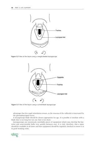 36 PART 2 LIFE SUPPORT
advantage that less vagal stimulation ensues, as the mucosa of the vallecula is innervated by
the glossopharyngeal nerve.
A laryngoscope blade should be chosen appropriate for age. It is possible to intubate with a
blade that is too long but not one that is too short.
Laryngoscopes are notoriously unreliable pieces of equipment which may develop ﬂat bat-
teries and unserviceable bulbs very quickly between uses. It is vital, therefore, that a spare
should be available at all times and that equipment should be regularly checked to ensure it is
in good working order.
Figure 5.2 View of the larynx using a straight-bladed laryngoscope
Figure 5.3 View of the larynx using a curved-blade laryngoscope
 