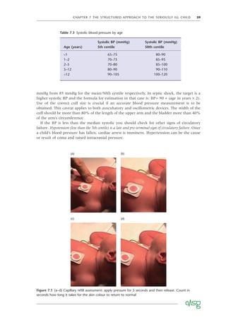 CHAPTER 7 THE STRUCTURED APPROACH TO THE SERIOUSLY ILL CHILD 59
Figure 7.1 (a–d) Capillary reﬁll assessment: apply pressure for 5 seconds and then release. Count in
seconds how long it takes for the skin colour to return to normal
(a) (b)
(c) (d)
mmHg from 85 mmHg for the mean/50th centile respectively. In septic shock, the target is a
higher systolic BP and the formula for estimation in that case is: BP= 90 + (age in years × 2).
Use of the correct cuff size is crucial if an accurate blood pressure measurement is to be
obtained. This caveat applies to both auscultatory and oscillometric devices. The width of the
cuff should be more than 80% of the length of the upper arm and the bladder more than 40%
of the arm’s circumference.
If the BP is less than the median systolic you should check for other signs of circulatory
failure. Hypotension (less than the 5th centile) is a late and pre-terminal sign of circulatory failure. Once
a child’s blood pressure has fallen, cardiac arrest is imminent. Hypertension can be the cause
or result of coma and raised intracranial pressure.
Table 7.3 Systolic blood pressure by age
Age (years)
Systolic BP (mmHg)
5th centile
Systolic BP (mmHg)
50th centile
<1 65–75 80–90
1–2 70–75 85–95
2–5 70–80 85–100
5–12 80–90 90–110
>12 90–105 100–120
 