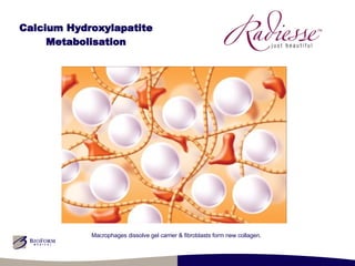 Calcium Hydroxylapatite Metabolisation Macrophages dissolve gel carrier & fibroblasts form new collagen. 