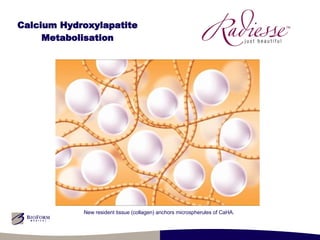 Calcium Hydroxylapatite Metabolisation New resident tissue (collagen) anchors microspherules of CaHA. 