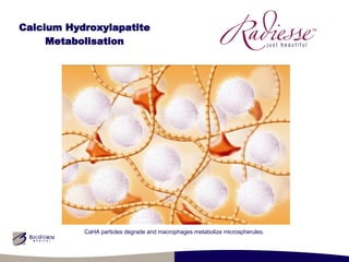 Calcium Hydroxylapatite Metabolisation CaHA particles degrade and macrophages metabolize microspherules. 