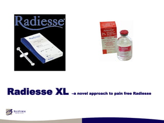 Radiesse XL  –a novel approach to pain free Radiesse 
