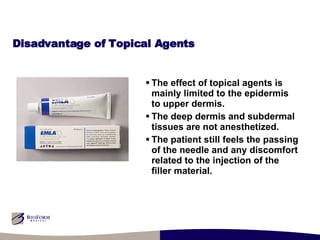 Disadvantage of Topical Agents The effect of topical agents is mainly limited to the epidermis to upper dermis. The deep dermis and subdermal tissues are not anesthetized. The patient still feels the passing of the needle and any discomfort related to the injection of the filler material. 