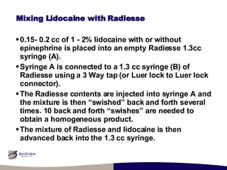 Mixing Lidocaine with Radiesse 0.15- 0.2 cc of 1 - 2% lidocaine with or without epinephrine is placed into an empty Radiesse 1.3cc syringe (A). Syringe A is connected to a 1.3 cc syringe (B) of Radiesse using a 3 Way tap (or Luer lock to Luer lock connector). The Radiesse contents are injected into syringe A and the mixture is then “swished” back and forth several times. 10 back and forth “swishes” are needed to obtain a homogeneous product. The mixture of Radiesse and lidocaine is then advanced back into the 1.3 cc syringe. 