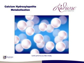 Calcium Hydroxylapatite Metabolisation CaHA performs as a filler initially. 