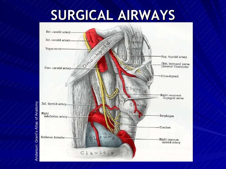 Advanced airway