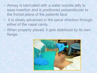  Airway is lubricated with a water soluble jelly to
ease insertion and is positioned perpendicular to
the frontal plane of the patients face
 It is slowly advanced in the same direction through
either of the nasal cavity
 When properly placed, it gets stabilized by its own
flange
 