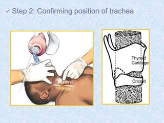  Step 2: Confirming position of trachea
 