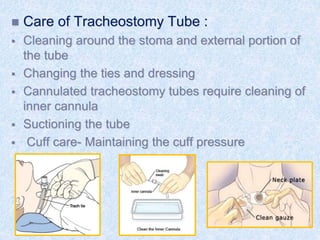  Care of Tracheostomy Tube :
 Cleaning around the stoma and external portion of
the tube
 Changing the ties and dressing
 Cannulated tracheostomy tubes require cleaning of
inner cannula
 Suctioning the tube
 Cuff care- Maintaining the cuff pressure
 