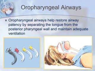 Oropharyngeal Airways
 Oropharyngeal airways help restore airway
patency by separating the tongue from the
posterior pharyngeal wall and maintain adequate
ventilation
 